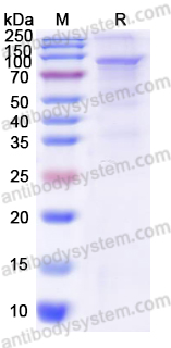 Recombinant Human PFKM Protein, N-His