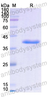 Recombinant Human ASNS Protein, N-His