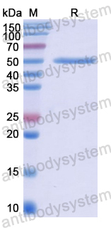 Recombinant Human ELANE Protein, N-GST