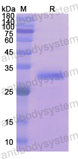 Recombinant Human Synaptophysin/SYP Protein, N-His