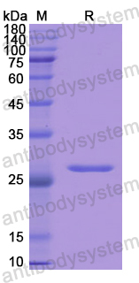 Recombinant Human GSTA1 Protein, N-His