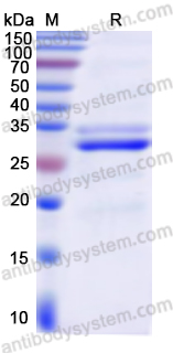 Recombinant Human SOD3 Protein, N-His