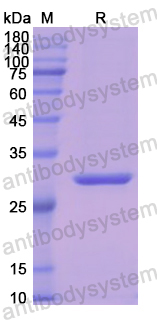 Recombinant Human HMBS Protein, N-His