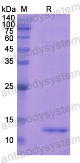 Recombinant Human MGP Protein, N-His