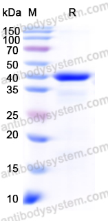 Recombinant Human PDHA1 Protein, N-His