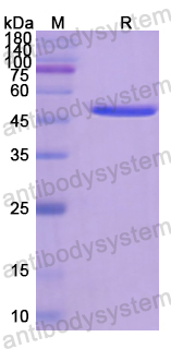 Recombinant Human CD45/PTPRC Protein, N-His