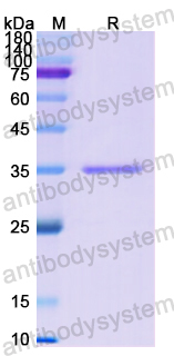 Recombinant Human MET/c-Met/HGFR Protein, N-His