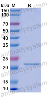Recombinant Human MYL3 Protein, N-His