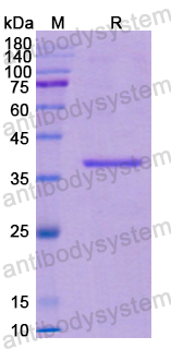 Recombinant Human CFH Protein, N-His