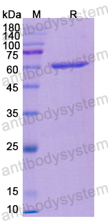 Recombinant Human HCK Protein, N-His