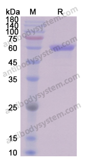 Recombinant Human VIM/Vimentin Protein, N-His