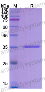 Recombinant Human CYP21A2 Protein, N-His