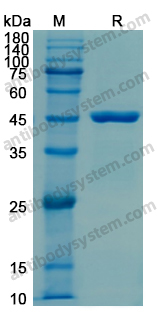 Recombinant Human KRT19/CK19 Protein, N-His