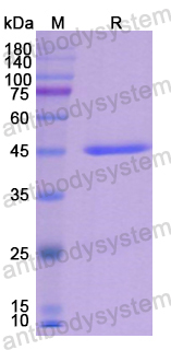 Recombinant Human KRT19/CK19 Protein, C-His