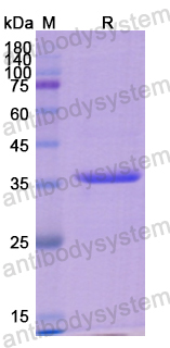 Recombinant Human KRT7 Protein, N-His