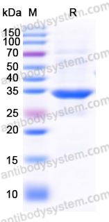 Recombinant Human ANXA5 Protein, N-His