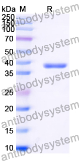 Recombinant Human ANXA5 Protein, N-His