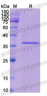 Recombinant Human KRT16 Protein, N-His