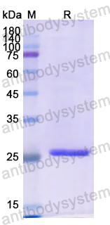 Recombinant Human IGFBP1 Protein, N-His