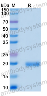 Recombinant Human STS Protein, N-His
