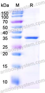 Recombinant Human CD126/IL6R/IL-6RA Protein, N-His