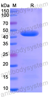 Recombinant Human ABHD2 Protein, N-His