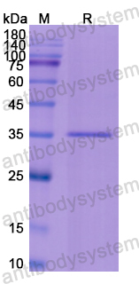 Recombinant Human ROS1 Protein, N-His