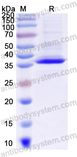 Recombinant Human NMB Protein, N-GST