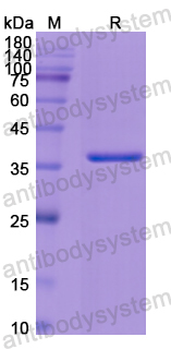 Recombinant Human CD63 Protein, N-GST