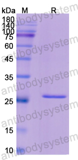 Recombinant Human ACAA1 Protein, N-His