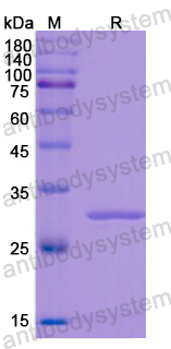 Recombinant Human DBH Protein, N-His