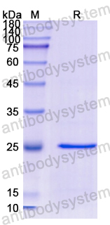 Recombinant Human GSTP1 Protein, N-His