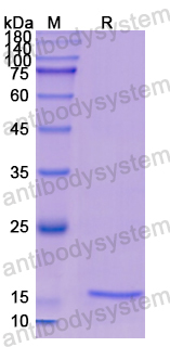 Recombinant Human CST2 Protein, N-His