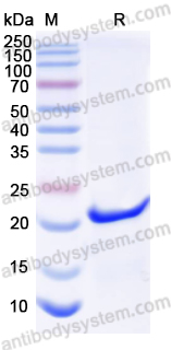 Recombinant Human MMP7 Protein, N-His