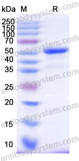 Recombinant Human MMP10 Protein, N-His