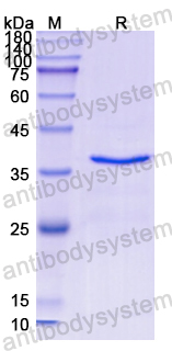 Recombinant Human VIL1 Protein, N-His