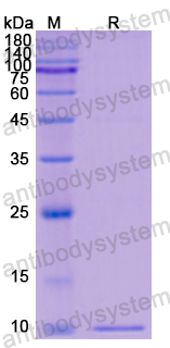 Recombinant Human RBP1 Protein, N-His