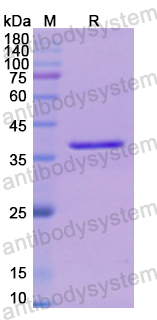 Recombinant Human FBP1 Protein, N-His