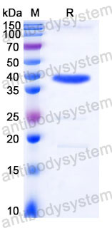 SDS-PAGE for Recombinant Human FBP1 Protein, C-His ?>