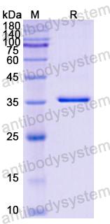 Recombinant Human SPARC Protein, N-His