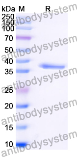 Recombinant Human SPARC/Osteonectin Protein, N-His-SUMO