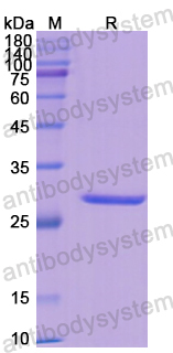 Recombinant Human GSTM1 Protein, N-His