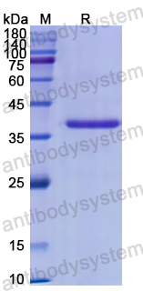 Recombinant Human ANXA4 Protein, N-His