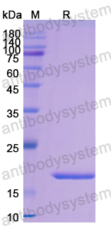 Recombinant Human CD7 Protein, N-His