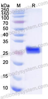 Recombinant Human HMOX1 Protein, N-His