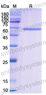 Recombinant Human CD140b/PDGFRB Protein, N-His