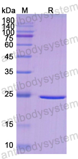 Recombinant Human DLD Protein, N-His