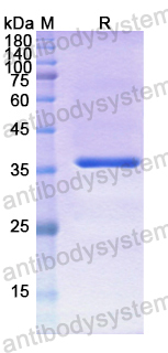 Recombinant Human CTSH Protein, N-His