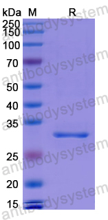 Recombinant Human C1S Protein, N-His