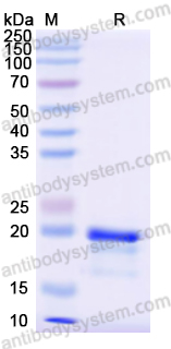 Recombinant Human PARP1 Protein, N-His